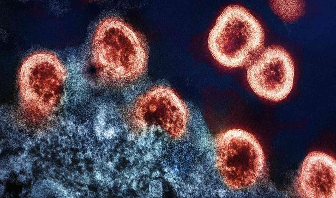 Scientists Discover Potential HIV Cure that Eliminates Disease from Cells Using CRISPR-Cas Gene Editing 